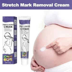 Stretch Marks Removal Maternity Cream That Nourishes Skin