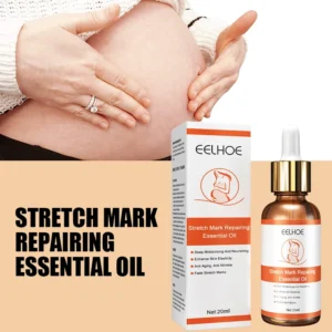 Essential Oil Treatment Cream Stretch Mark Remover Repair
