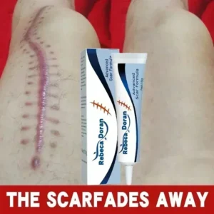 Very Effective Maternity Cream That Eliminates Stretch Marks